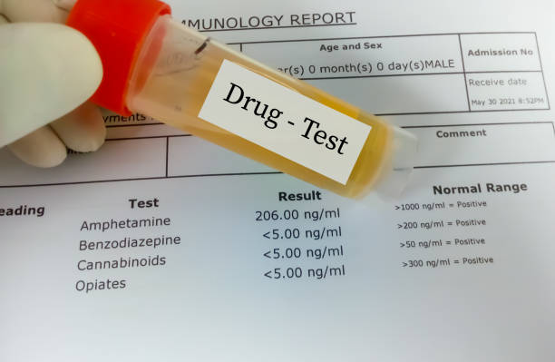 drogovy test